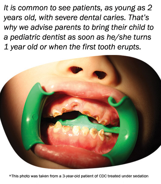 Common Problems | Children's Dental Center